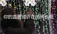 你的血管或许在悄悄长斑！这样做
，“斑块”可能缩小→