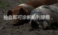 抽血即可诊断前列腺癌�，拜登为何不测？