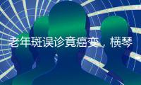 老年斑误诊竟癌变
，横琴医院提醒：医学美容需科学诊断与规范治疗